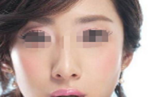 蘇州祛斑整形醫(yī)院哪家好？點擊查看排名前四家醫(yī)院名單！