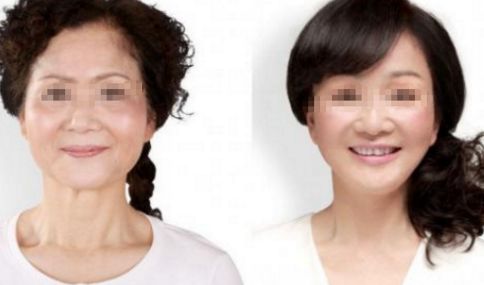 北京眼整形醫(yī)院排行榜：專業(yè)眼部整形推薦前六強(qiáng)！