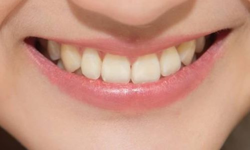 深圳哪里可以做安全可靠的抽脂手術(shù)？