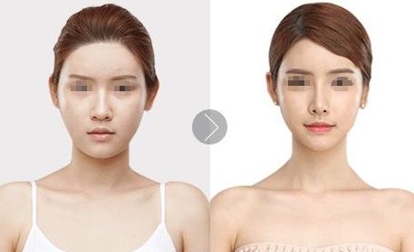 北京植發(fā)醫(yī)院推薦，哪家效果好？