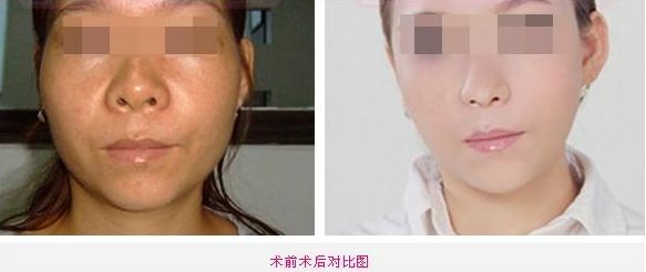 全新整容醫(yī)院推薦！這5家值得你關(guān)注