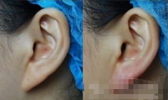 湖州哪家醫(yī)院能有效提升面部外觀？