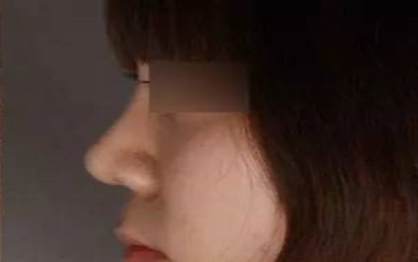 2023濟(jì)寧暢銷整形醫(yī)院匯總：抽脂技術(shù)亮眼，讓你輕松擁有完美身材！