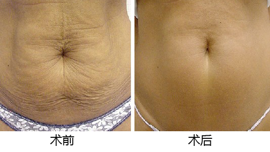 義烏整形醫(yī)院優(yōu)選TOP5，專業(yè)權(quán)威推薦，如何做出準(zhǔn)確選擇？深入了解為上策