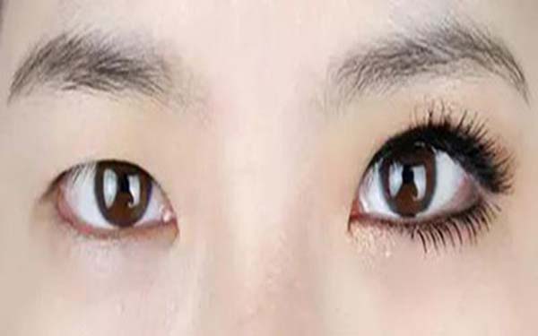 樂山整形醫(yī)院推薦：達芬奇與西嬋，你更喜歡哪一個？獲取比較結(jié)果！
