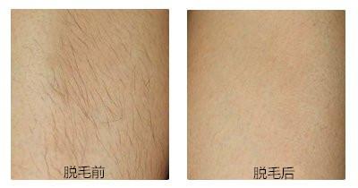 專業(yè)推薦！新疆頂級(jí)眼袋整形醫(yī)生綜合評(píng)價(jià)排行盤點(diǎn)