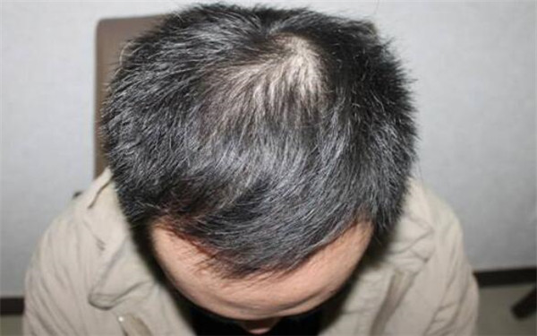 南昌三甲醫(yī)院全面盤(pán)點(diǎn)：專(zhuān)業(yè)美容整形醫(yī)院推薦，趕緊了解一下！