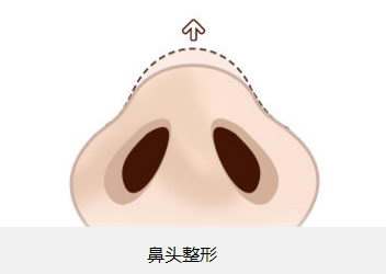 北京植眉醫(yī)院推薦：高新及新生，專業(yè)醫(yī)護(hù)技藝令人贊嘆！