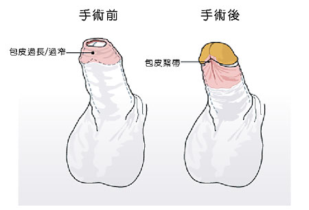 南京哪家醫(yī)院矯正牙齒比較好？推薦貝鶴雅康、美奧、貝芽、卡瓦、藍鱘等！