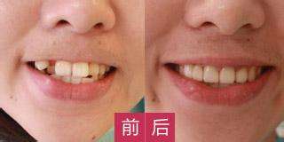 哪家醫(yī)院適合進行磨骨手術(shù)？江城和美立方廣受網(wǎng)友推崇！