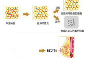 哪位醫(yī)生在八大處做雙眼皮效果最好？最受歡迎的五個(gè)口碑推薦！勢(shì)頭強(qiáng)勁！