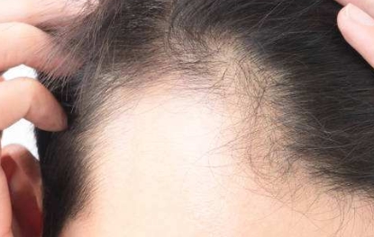 國內(nèi)頂級面部脂肪填充醫(yī)院盤點：頂尖專業(yè)團隊，選擇一定不后悔！