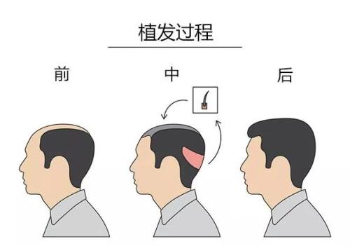 哈爾濱市排名靠前的整形醫(yī)院：公立與私立齊全，一定有一家適合您！