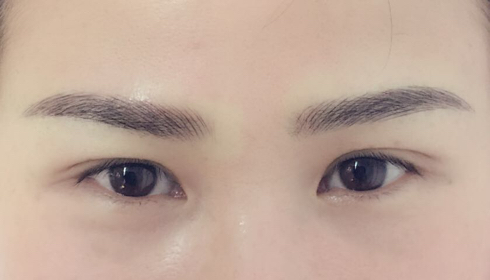 揭秘玉溪整形醫(yī)院匯總：華藝、吳氏嘉美等排行前六，此刻揭開！