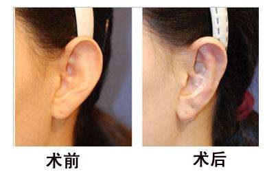 杭州首家頂級玻尿酸修復醫(yī)院:珠兒美容醫(yī)院實力獲得廣泛認可 杭州首家頂級玻尿酸修復醫(yī)院:珠兒美容醫(yī)院實力獲得廣泛認可