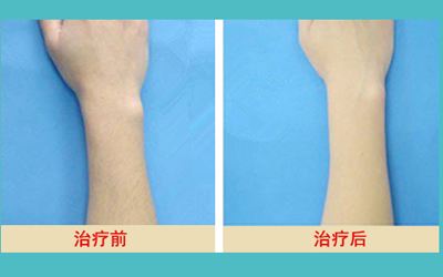 最新發(fā)布！匯總?cè)箩t(yī)院名單，解決牙齒問題待了整整一年