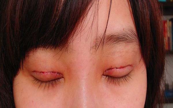 成都整形醫(yī)院修復隆鼻排行榜：前五強醫(yī)療機構(gòu)值得推薦！