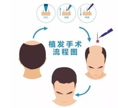 昆明哪家隆鼻醫(yī)院比較靠譜？【10所信譽極高的醫(yī)療機構】