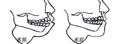 提供重慶哪家私立醫(yī)院割雙眼皮好？前五推薦_軍美領(lǐng)先，再揭秘