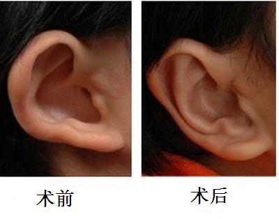 杭州口腔疾病治療首選！濃縮優(yōu)質(zhì)、平價(jià)口腔醫(yī)院一站攻略