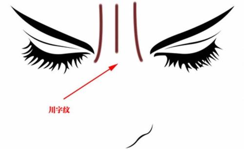 成都雙眼皮修復(fù)手術(shù)：五家性價比高、技術(shù)好的醫(yī)院推薦