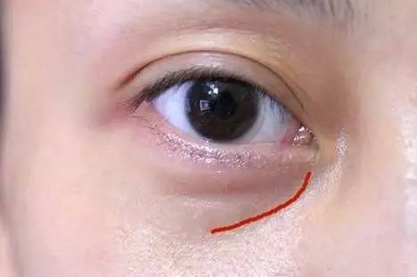 沈陽哪家醫(yī)院做雙眼皮好？推薦這幾家，讓你的雙眼美麗動人起來！