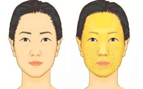 滄州治療疤痕的正規(guī)醫(yī)院推薦：專業(yè)科技祛疤，效果顯著！點擊了解！