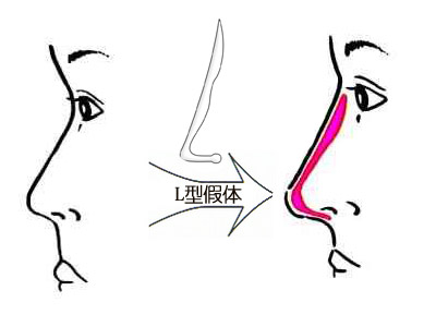 深圳最佳激光脫毛整形醫(yī)院推薦-公立醫(yī)院領(lǐng)跑市場(chǎng)！