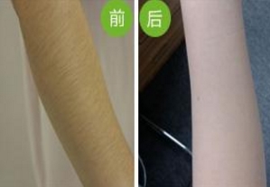 武漢頂尖整形醫(yī)院盤點：協(xié)和、美立方、壹加壹等脫穎而出！是否心儀醫(yī)院榜上有名？速來一探究竟！