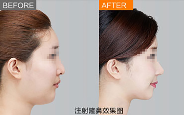 鄭州唇部整形醫(yī)院推薦：如何選擇合適的醫(yī)院？友友必看！