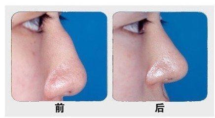 石家莊主要公立整形醫(yī)院排行榜！公辦醫(yī)療機構(gòu)最具實力！