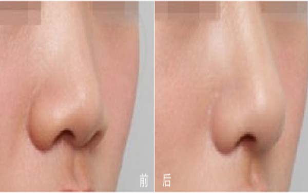 福建五所知名整形醫(yī)院盛世薈萃：瑞麗、愛思特、雅美等品牌強(qiáng)勢入圍！