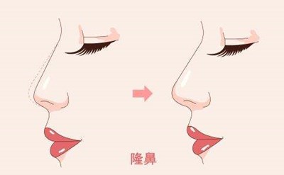 寧夏蛋白短線(xiàn)收緊面部醫(yī)生