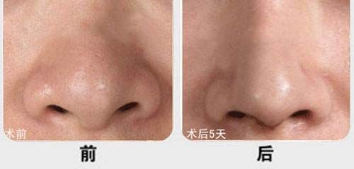 廈門市有哪些醫(yī)院提供優(yōu)質(zhì)的脂肪填充服務(wù)？江頭醫(yī)院、臉康整形醫(yī)院、美麗醫(yī)療中心等值得一看！快來了解一下