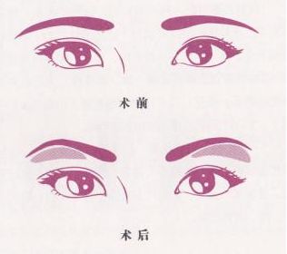 魅力煥發(fā)！常德市多家信譽(yù)醫(yī)院助你邁過疤痕困擾