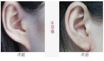 2023沈陽去魚尾紋雕塑醫(yī)院排行榜，這十家都備受口碑推崇！