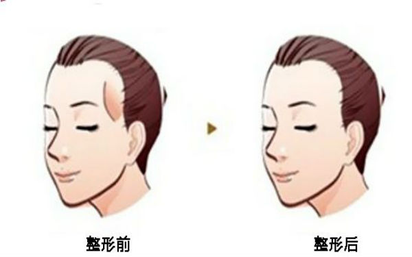 西寧顴骨矯正術(shù)：哪家醫(yī)院口碑好？2023年口碑排名前10的正規(guī)醫(yī)療整形醫(yī)院公布！