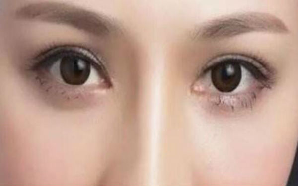 2023年選擇好的常德三點雙眼皮醫(yī)院，整形效果有哪些？排名前十強(qiáng)醫(yī)院值得信賴！
