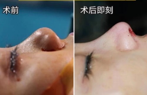 南京最熱門的環(huán)形精雕吸脂醫(yī)療美容醫(yī)院綜合推薦！2023年排行前十名大揭曉！