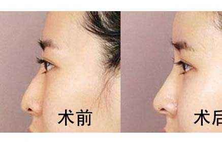 六安市受歡迎的雙眼皮整形美容醫(yī)院排行榜出爐！2023最值得信賴的明眸翹睫醫(yī)療機(jī)構(gòu)盤點(diǎn)！