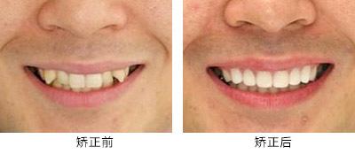 高性價(jià)比的滁州曼托水滴型假體隆胸整形醫(yī)院推薦！2023年滁州曼托水滴型假體隆胸醫(yī)院TOP10口碑排行，實(shí)力醫(yī)