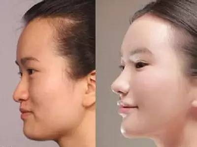 2023年，哪些上海自體脂肪面部精雕整形醫(yī)院的口碑特別好？排名榜前十值得信賴(lài)的美容整形醫(yī)院！