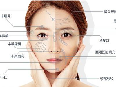 廣州臉部打溶脂針排名前10的美容醫(yī)院口碑大揭秘！2023年很受好評(píng)的整形醫(yī)院技術(shù)盤點(diǎn)！