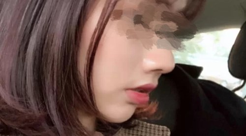 貴陽(yáng)有哪些專業(yè)的磨皮去痘印醫(yī)院？2023年TOP10推薦實(shí)力醫(yī)院揭曉