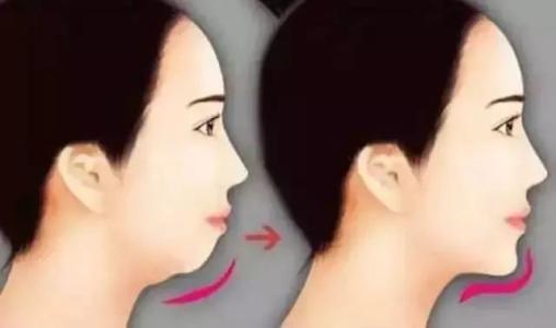 無錫有哪些正規(guī)的西藥酒糟鼻治療整形醫(yī)院？2023年無錫鼻整形醫(yī)院口碑排名前十匯總！