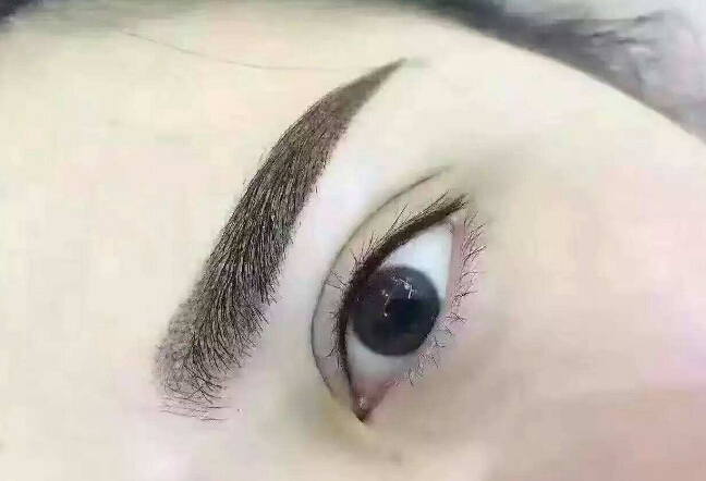 鄭州眉間紋淡化，2023年十大整形美容醫(yī)院推薦