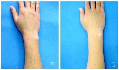 杭州哪家整形美容醫(yī)院能有效避免眼部皺紋？2023年杭州眼部皺紋美容醫(yī)院前十位排行榜來啦！