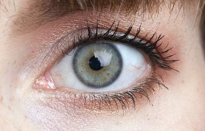 深圳哪個醫(yī)院的顴骨降低整形效果？2023年度排名前十大整形醫(yī)院點評！