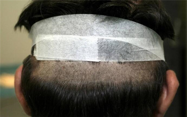 重慶哪家醫(yī)院豐唇口碑好？2023年榜單前十大整形美容醫(yī)院推薦！