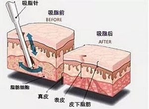 2023蕪湖鼻梁骨矯正醫(yī)院久負(fù)盛名，口碑贊譽(yù)不絕于耳！